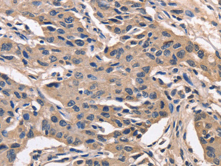 PEBP1 Polyclonal Antibody Store at -20°C