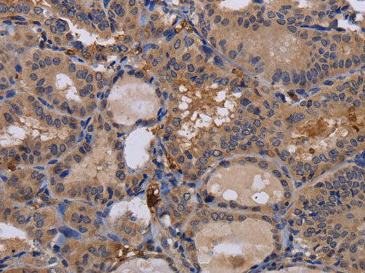 FADS1 Polyclonal Antibody Store at -20°C