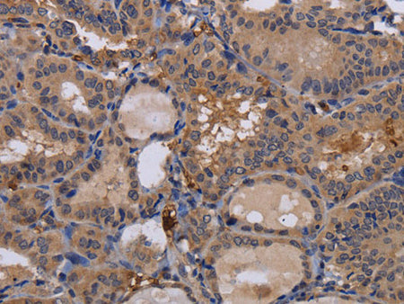 FADS1 Polyclonal Antibody Store at -20°C