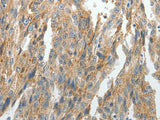 PRDX5 Polyclonal Antibody