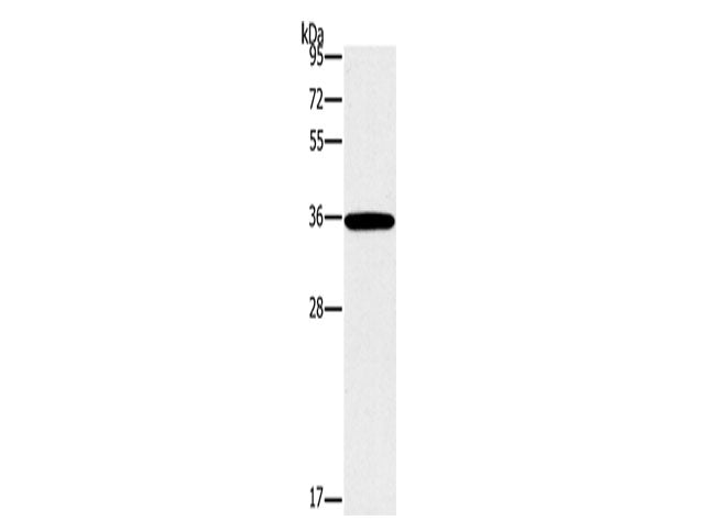 FOSL1 Polyclonal Antibody Store at -20°C