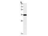 FOSL1 Polyclonal Antibody Store at -20°C