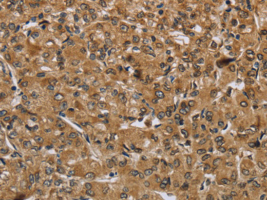 IKBIP Polyclonal Antibody Store at -20°C