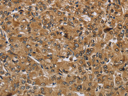 IKBIP Polyclonal Antibody Store at -20°C