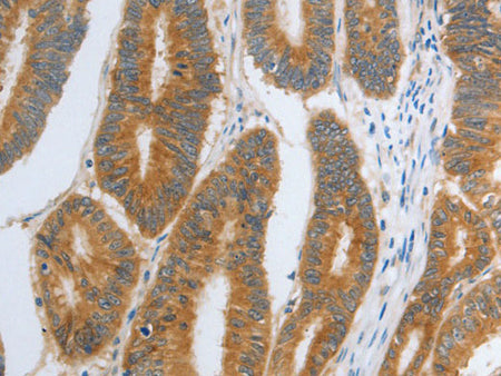 RHEB Polyclonal Antibody Store at -20°C
