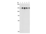 DDB1 Polyclonal Antibody Store at -20°C