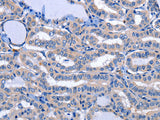 NPPB Polyclonal Antibody Store at -20°C