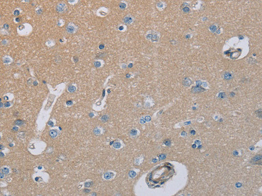 HSD3B7 Polyclonal Antibody Store at -20°C