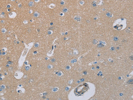 HSD3B7 Polyclonal Antibody Store at -20°C