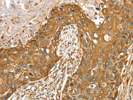 RASSF9 Polyclonal Antibody Store at -20°C