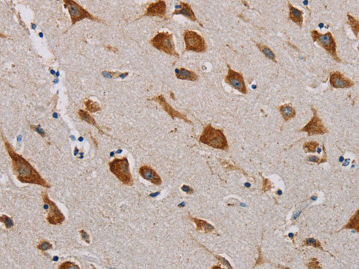MTF2 Polyclonal Antibody Store at -20°C