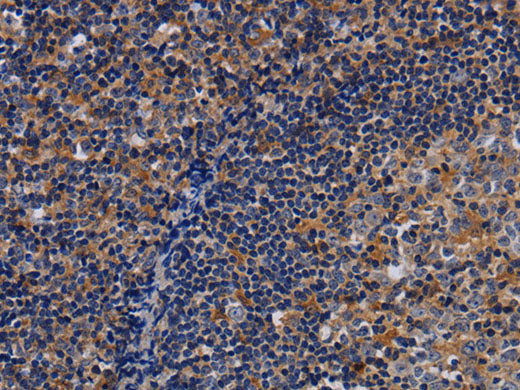 LIMS1 Polyclonal Antibody