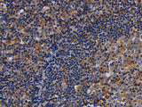 LIMS1 Polyclonal Antibody