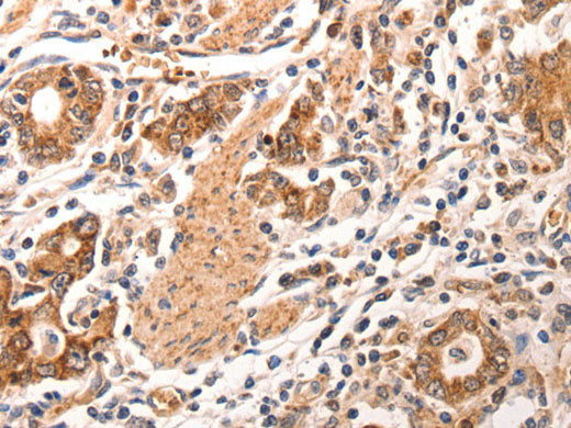 CCL17 Polyclonal Antibody