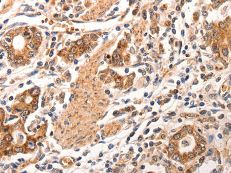 CCL17 Polyclonal Antibody