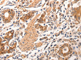 CCL17 Polyclonal Antibody