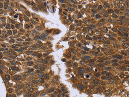FGFR1OP Polyclonal Antibody Store at -20°C