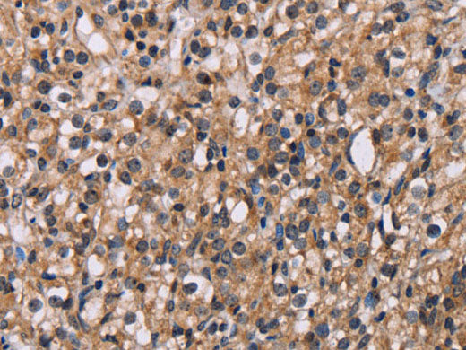 GNL3 Polyclonal Antibody Store at -20°C