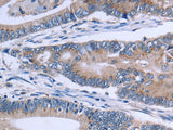 SLC1A6 Polyclonal Antibody Store at -20°C