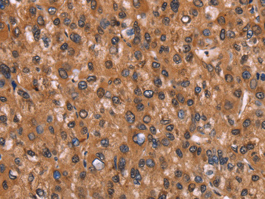 HINT1 Polyclonal Antibody Store at -20°C