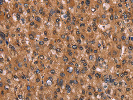 HINT1 Polyclonal Antibody Store at -20°C