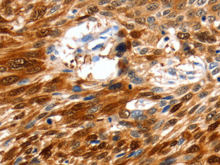 NCOR1 Polyclonal Antibody Store at -20°C