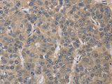 ELOVL1 Polyclonal Antibody