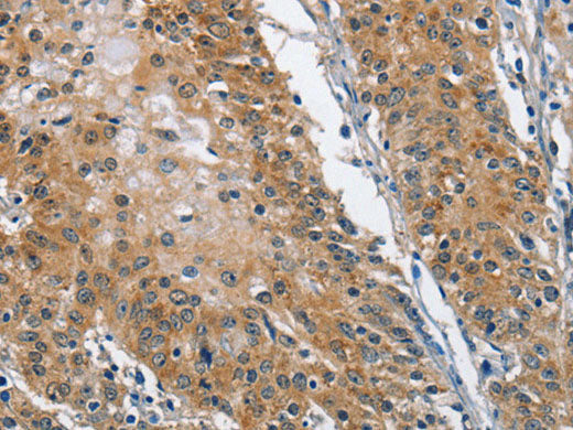 TRIP4 Polyclonal Antibody Store at -20°C
