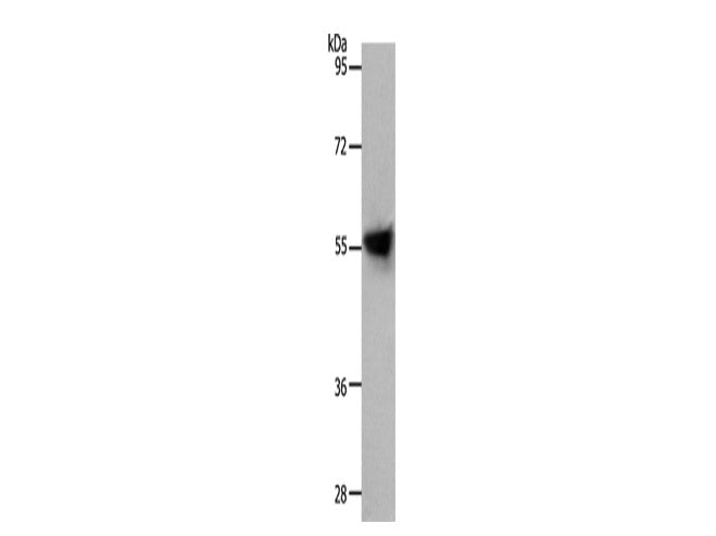 SLC1A4 Polyclonal Antibody