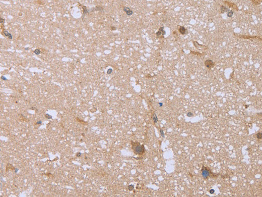 FHL2 Polyclonal Antibody Store at -20°C
