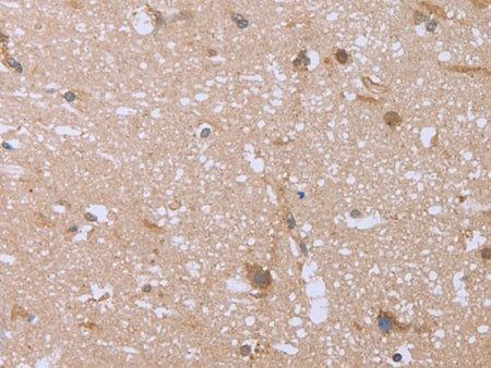 FHL2 Polyclonal Antibody Store at -20°C