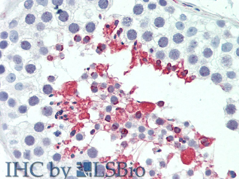 LIPE Polyclonal Antibody Store at -20°C