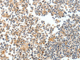 SPDEF Polyclonal Antibody