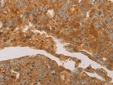 CD31 Polyclonal Antibody Store at -20°C