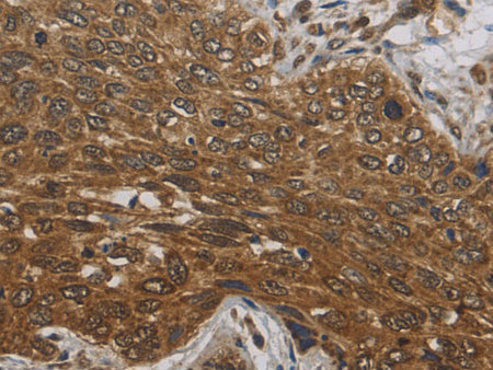 DCTN3 Polyclonal Antibody Store at -20°C