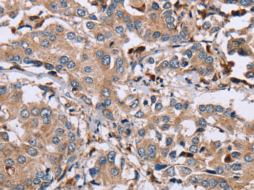 MAGEA3 Polyclonal Antibody