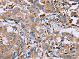 MAGEA3 Polyclonal Antibody