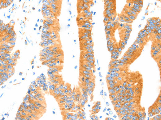 MANF Polyclonal Antibody Store at -20°C