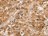 CTNNBIP1 Polyclonal Antibody