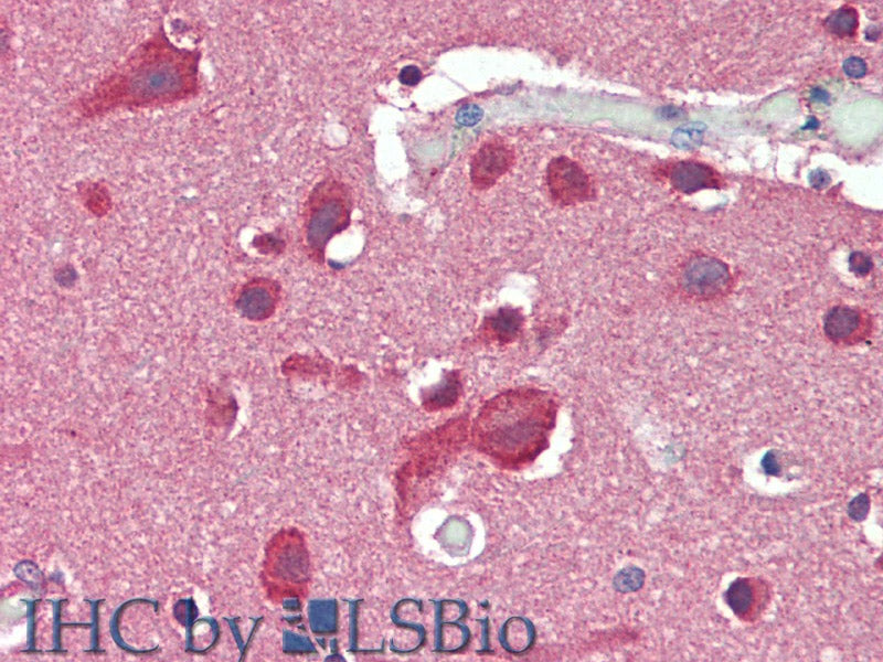 SLC8A3 Polyclonal Antibody Store at -20°C