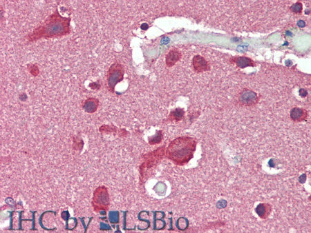 SLC8A3 Polyclonal Antibody Store at -20°C