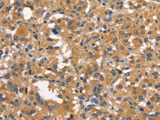 DNM2 Polyclonal Antibody Store at -20°C