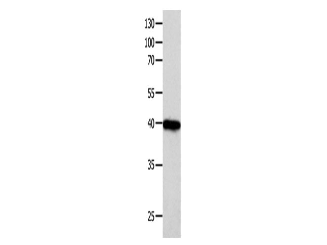 FOXL1 Polyclonal Antibody Store at -20°C