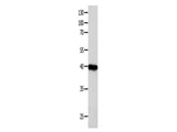 FOXL1 Polyclonal Antibody Store at -20°C