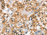 Cav1.2 Polyclonal Antibody
