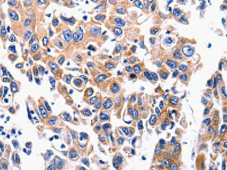 ACE2 Polyclonal Antibody Store at -20°C