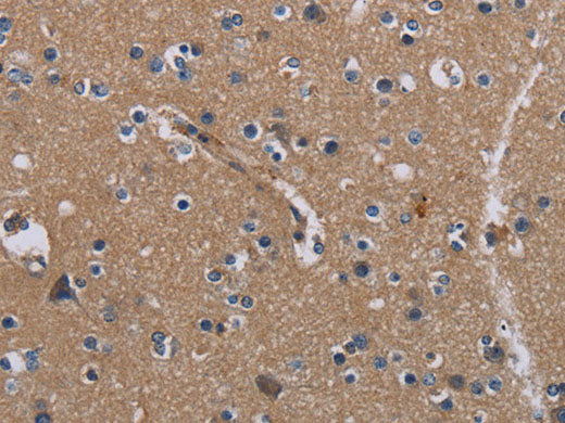 PIDD1 Polyclonal Antibody Store at -20°C