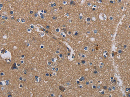 PIDD1 Polyclonal Antibody Store at -20°C