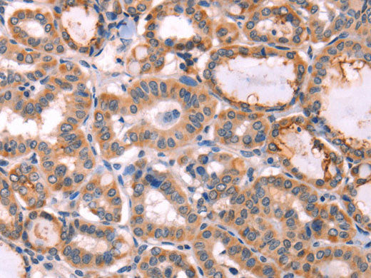 PROS1 Polyclonal Antibody Store at -20°C