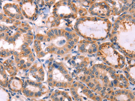 PROS1 Polyclonal Antibody Store at -20°C